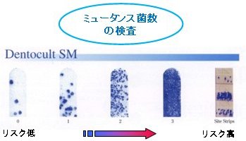 予防歯科