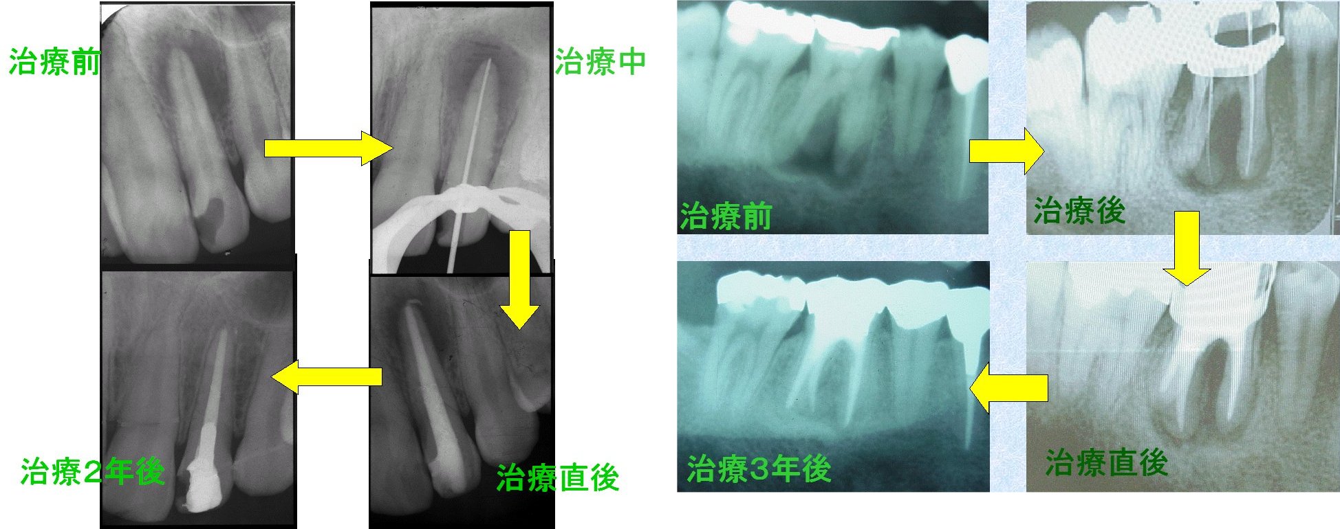 一般歯科